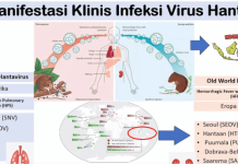 Kasus Hantavirus Jadi Perhatian, Kemenkes Perkuat Surveilans