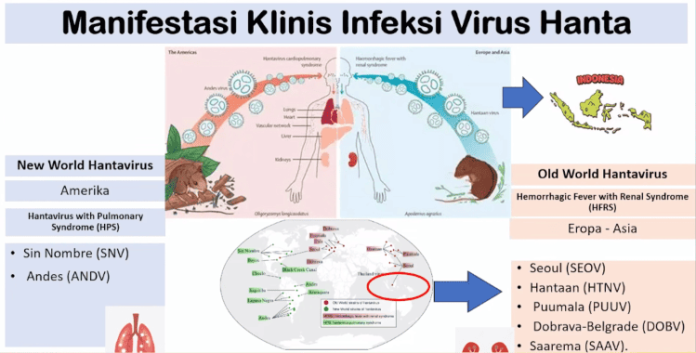 hantavirus (1)